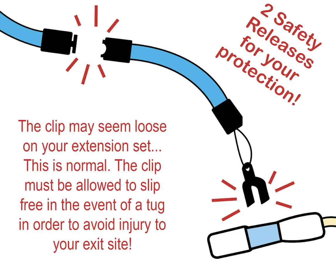 Thay thế kẹp PD Showermate cho catheter PD