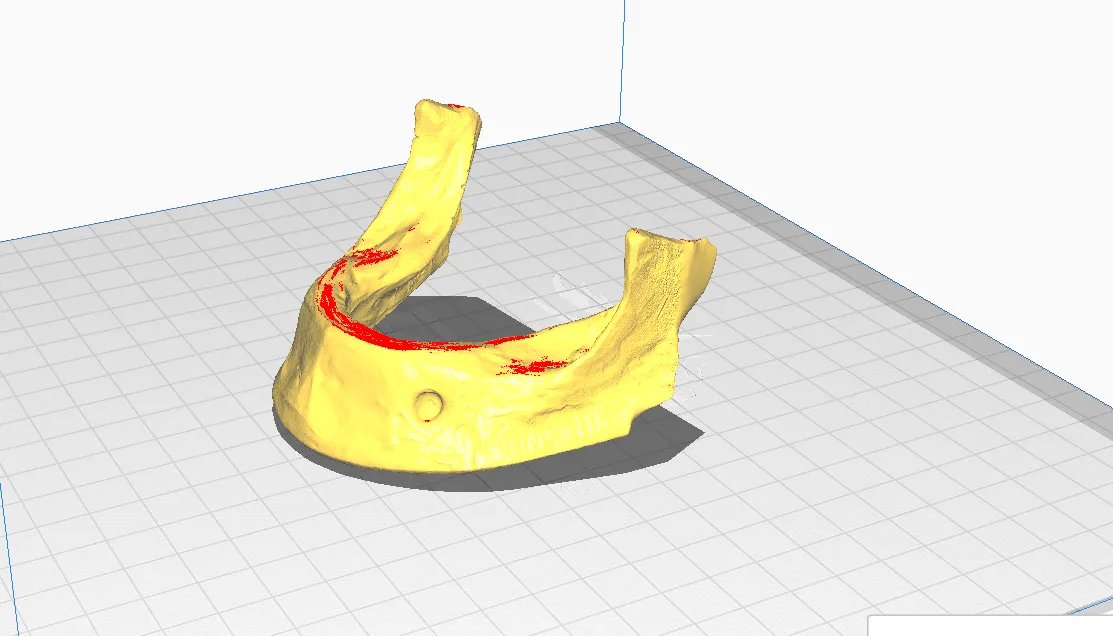 Mô hình hàm dưới không răng in 3D cho giáo dục y khoa