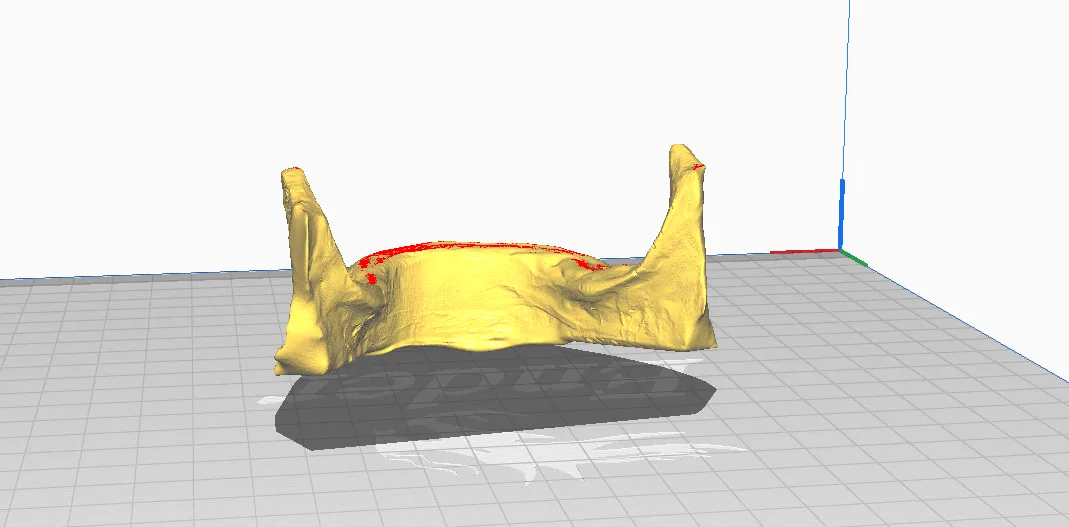 Mô hình hàm dưới không răng in 3D cho giáo dục y khoa