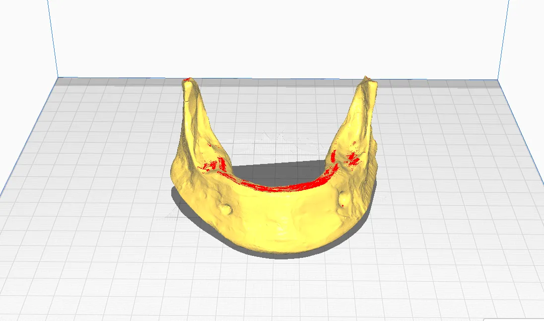 Mô hình hàm dưới không răng in 3D cho giáo dục y khoa