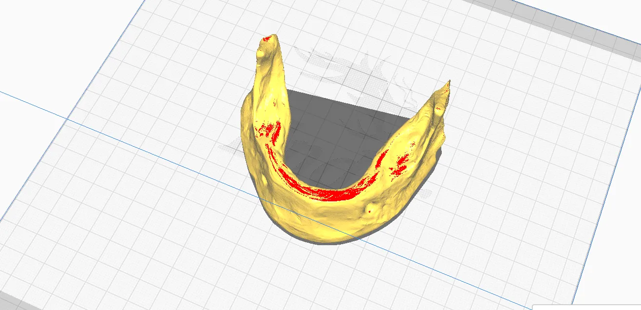 Mô hình hàm dưới không răng in 3D cho giáo dục y khoa