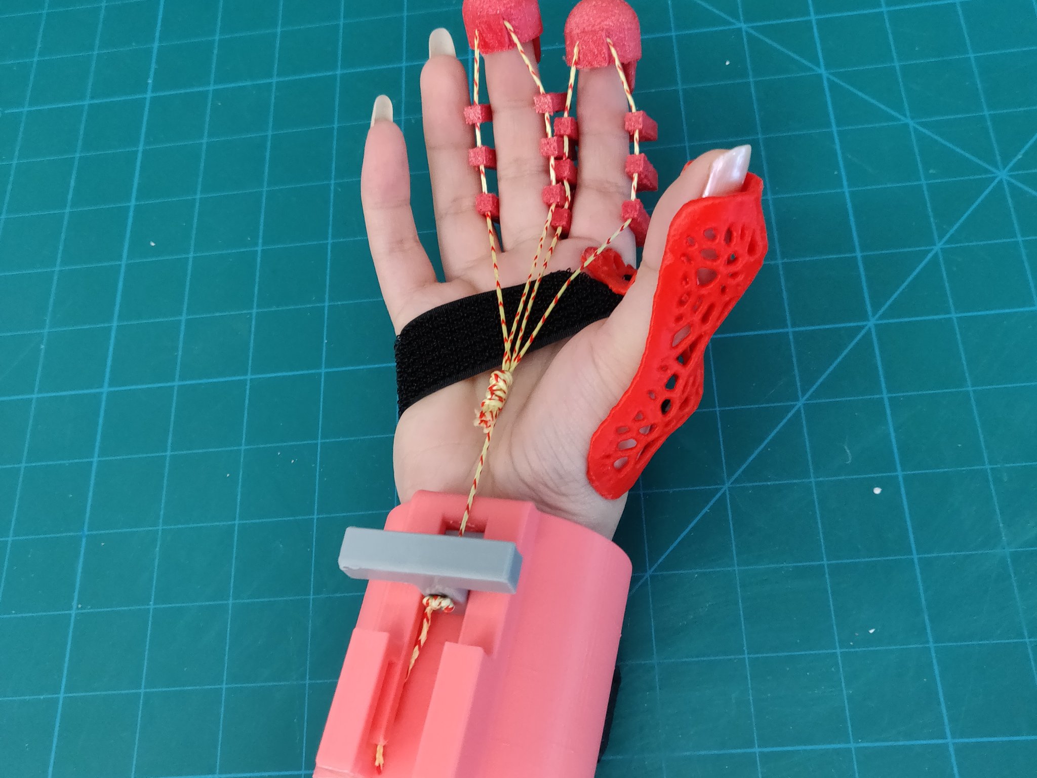 Găng tay phục hồi chức năng cho bệnh nhân đột quỵ