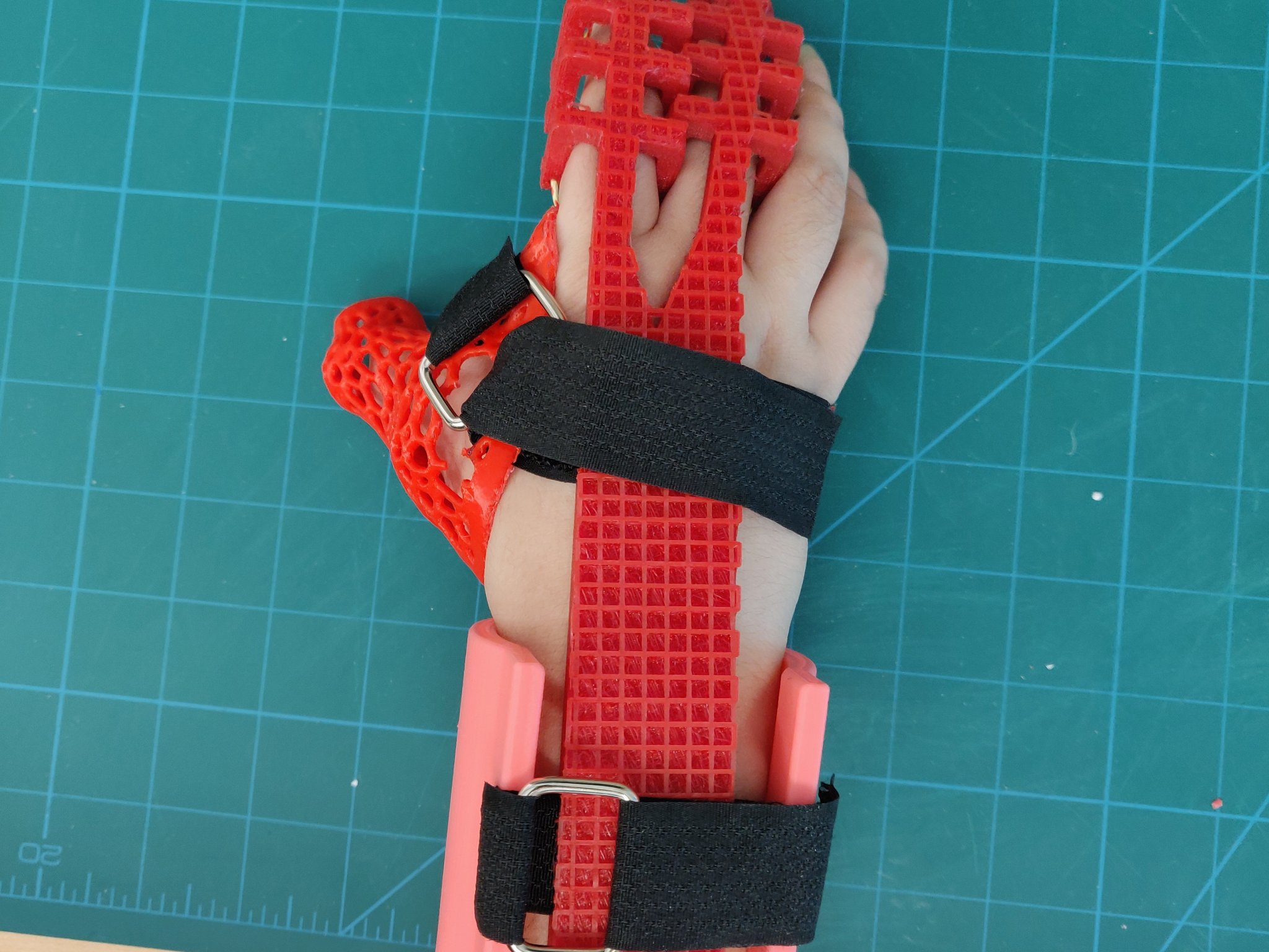 Găng tay phục hồi chức năng cho bệnh nhân đột quỵ