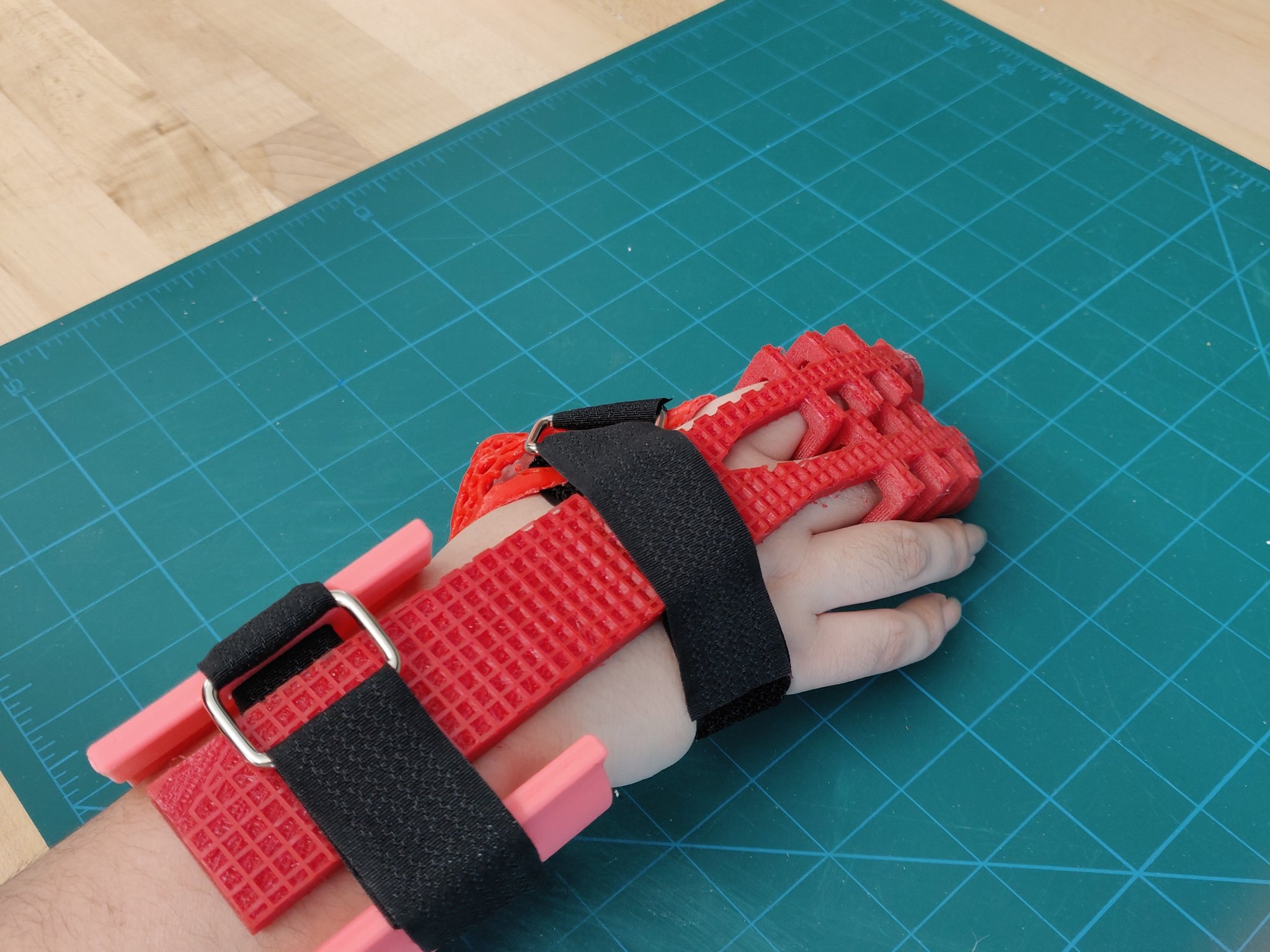 Găng tay phục hồi chức năng cho bệnh nhân đột quỵ