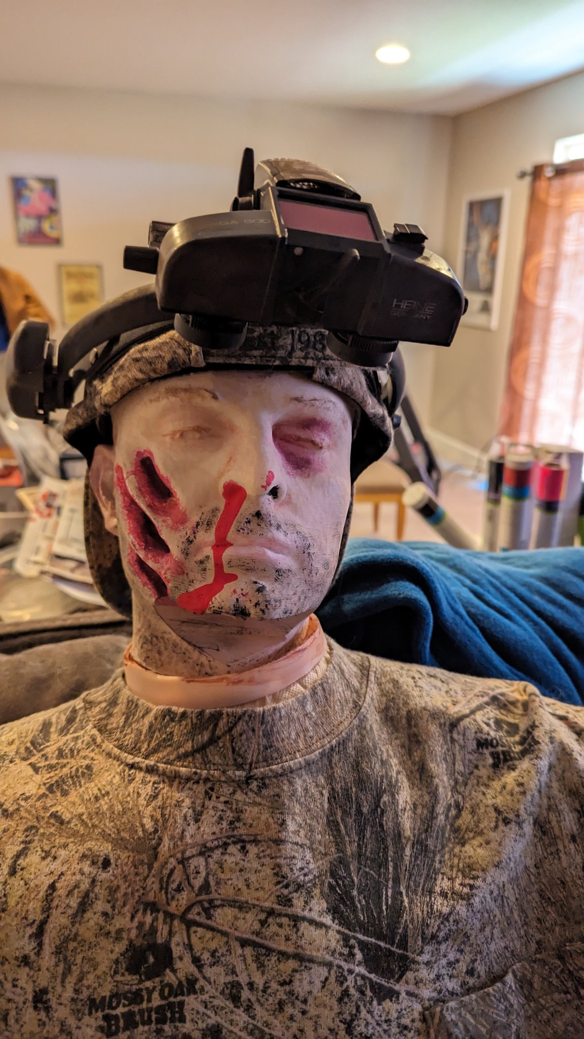 Xác chết đầu lính do tấn công của động vật hoặc người n...