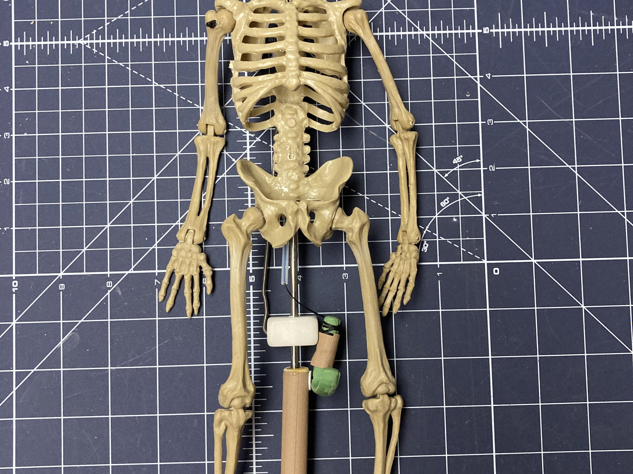 Bộ kích hoạt và giá đỡ cho rối xương