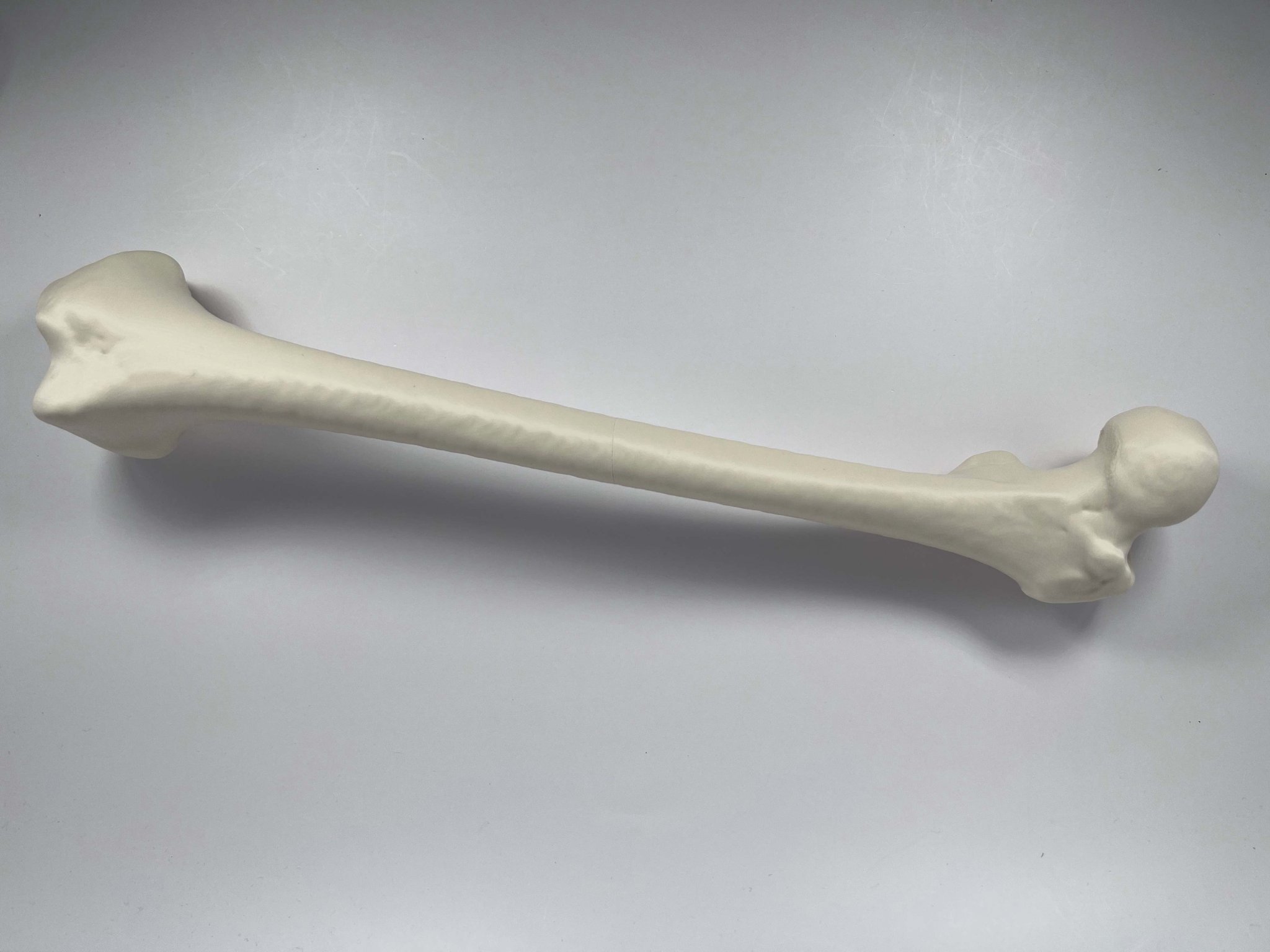 Xương đùi trái của người từ hình chụp CT