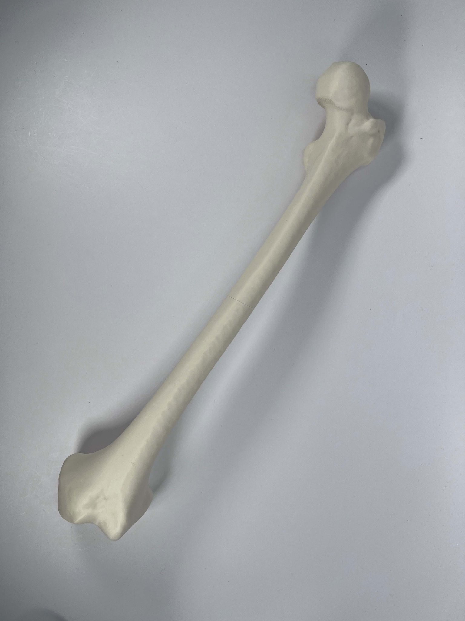 Xương đùi trái của người từ hình chụp CT