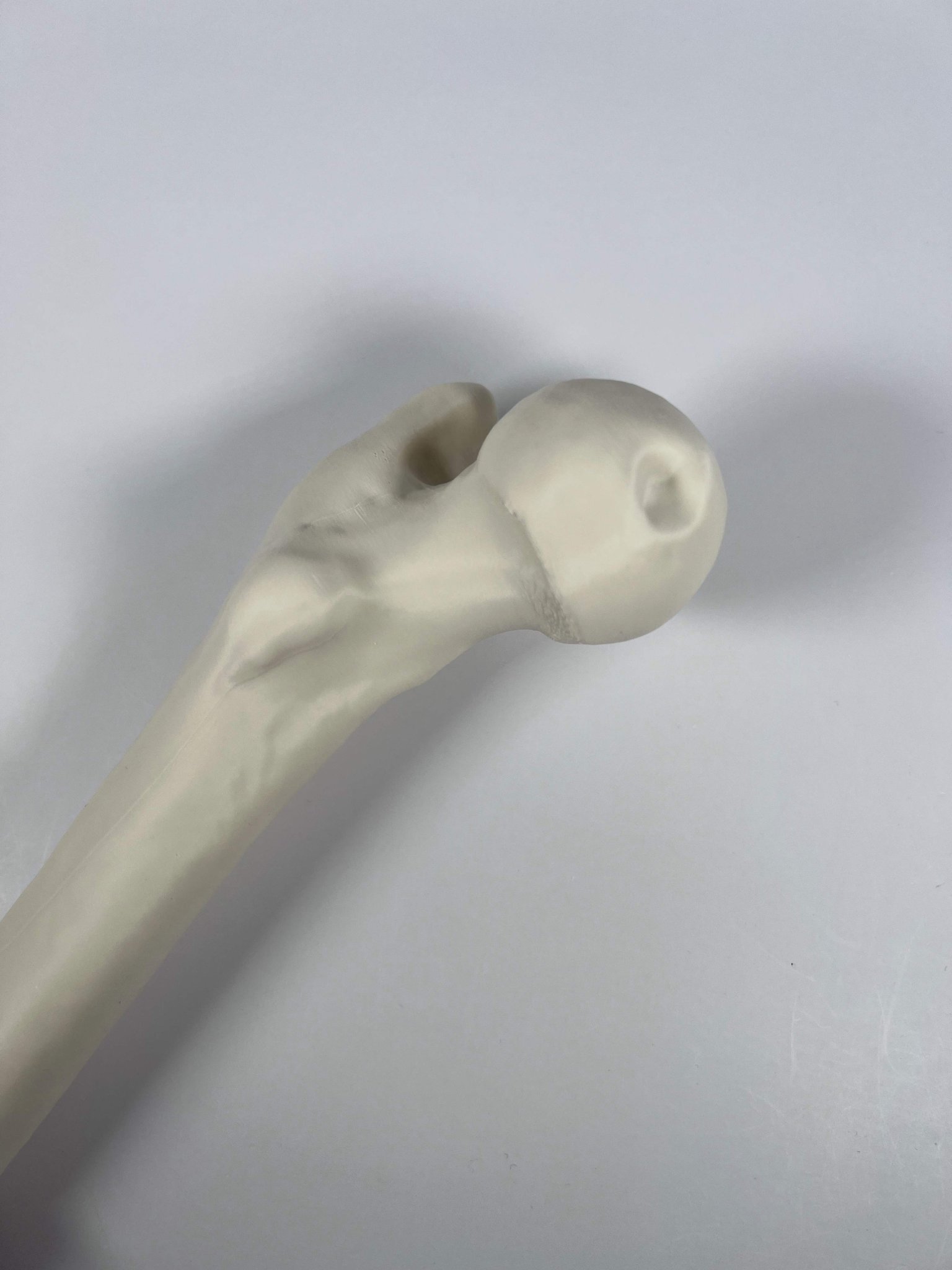 Xương đùi trái của người từ hình chụp CT