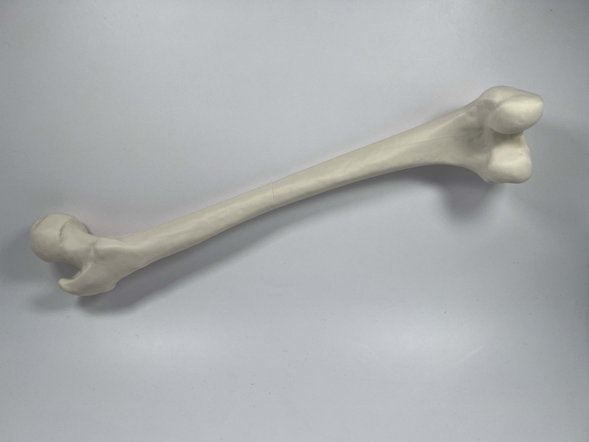 Xương đùi trái của người từ hình chụp CT