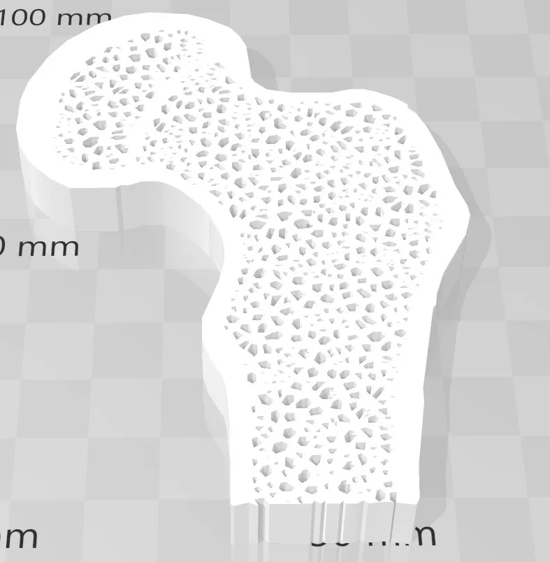 Mặt cắt xương với sự khác biệt giữa xương khỏe và xương...
