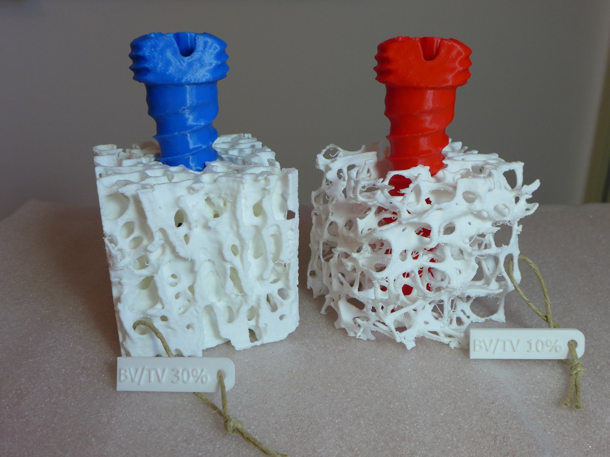 Mô hình xương bè loãng xương kèm vít xương