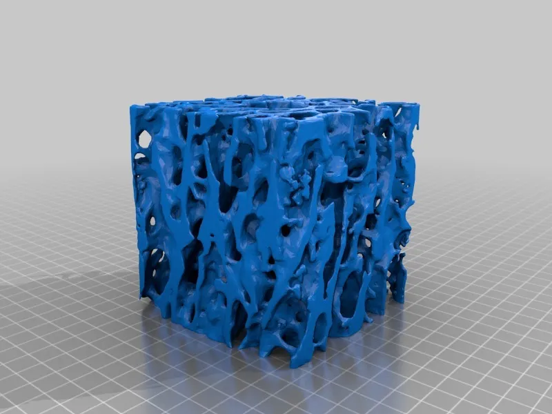 Mô hình xương bè loãng xương kèm vít xương