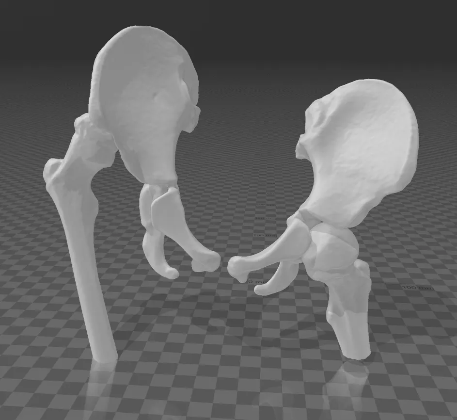 Tiêu đề Hip Tóm tắt Segacja stawów biodrowych wraz z kośćmi udowymi