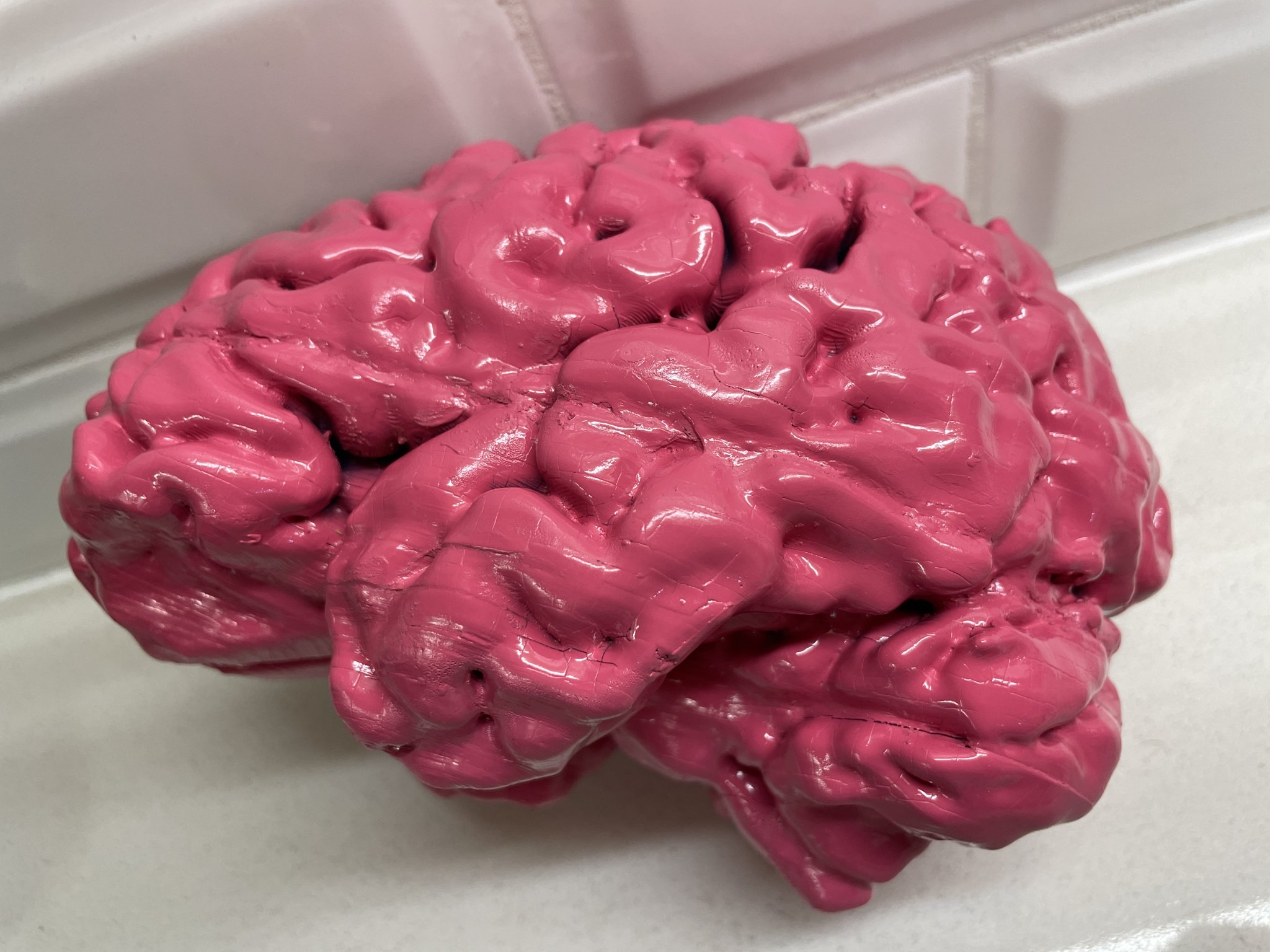 Anatomically Correct Human Brain From MRI Scan