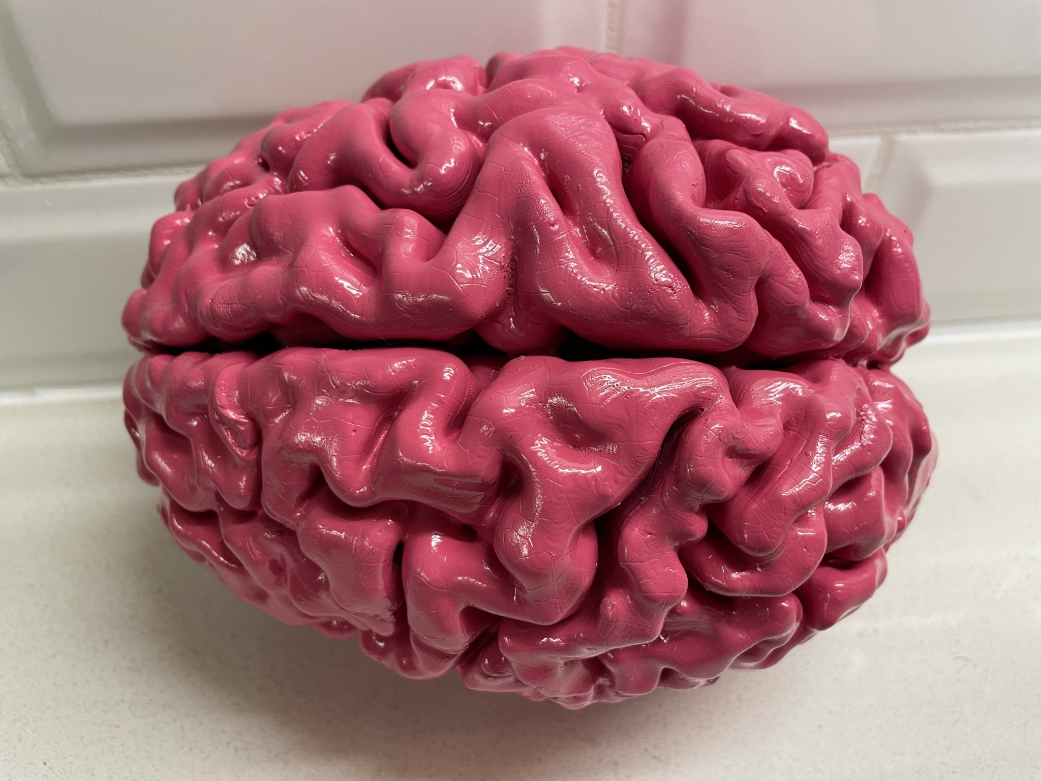 Anatomically Correct Human Brain From MRI Scan