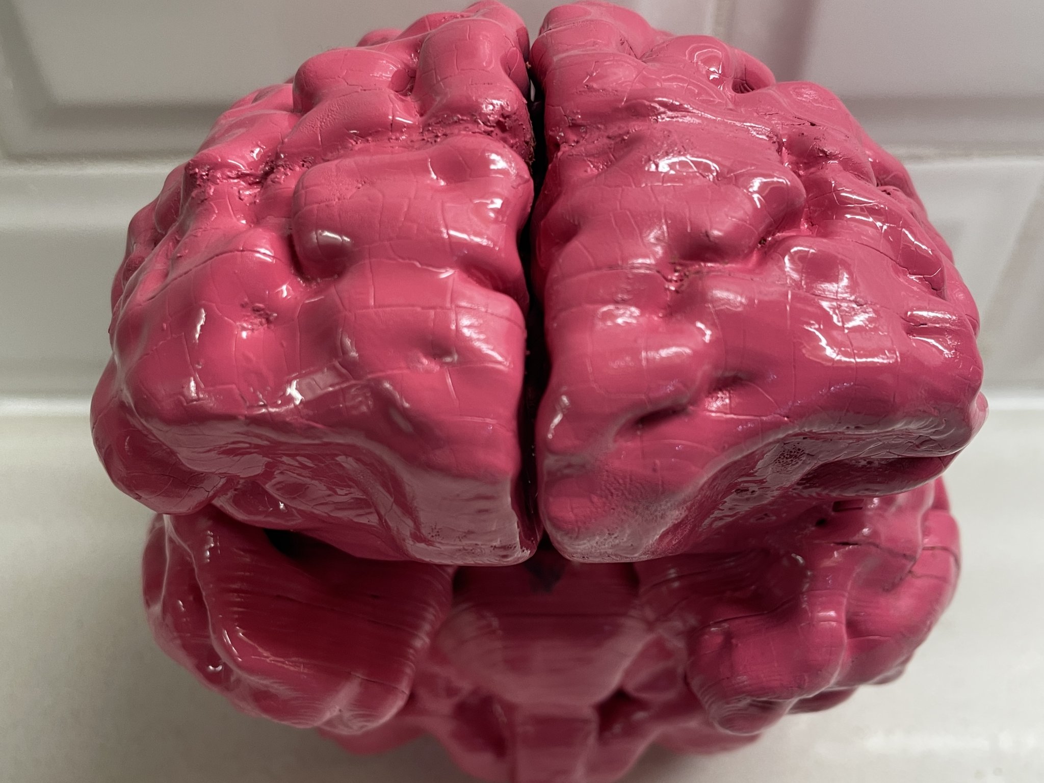 Anatomically Correct Human Brain From MRI Scan