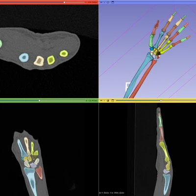 Mô Hình Cánh Tay Dưới Linh Hoạt Kích Thước Thật