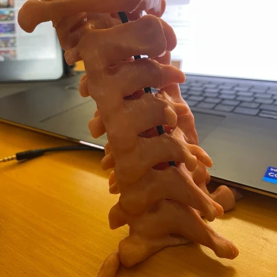 Cột sống cổ (C1 đến C7)