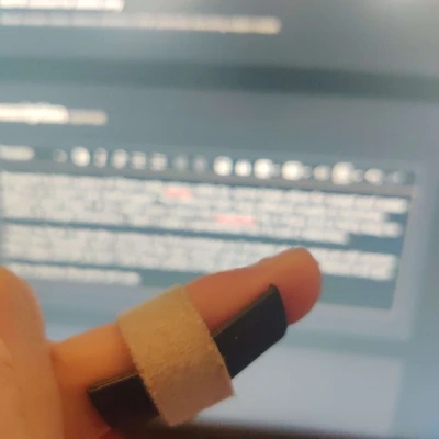 Nẹp Ngón Tay - Bong Gân Ngón Tay