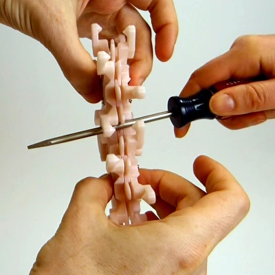 Bánh Răng Ăn Khớp