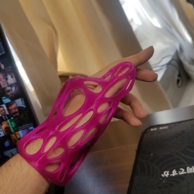 Nẹp Bảo Vệ Ngón Cái Tùy Chỉnh Theo Số Đo