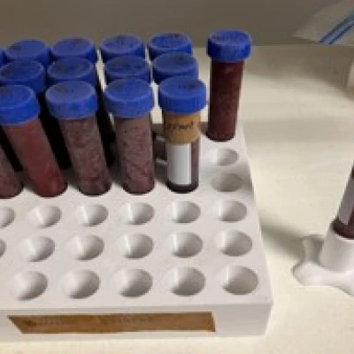 Giá Đỡ Ống Ly Tâm 15ml (36 Ống)