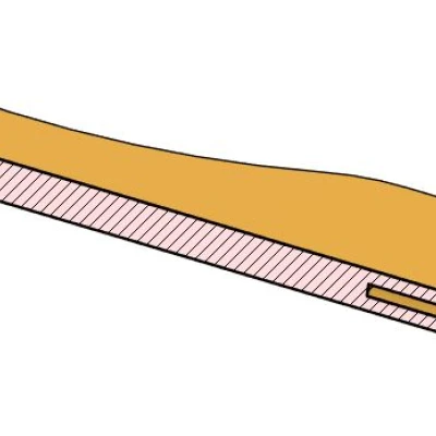 Mở Bia Gắn Đồng 5 Cent