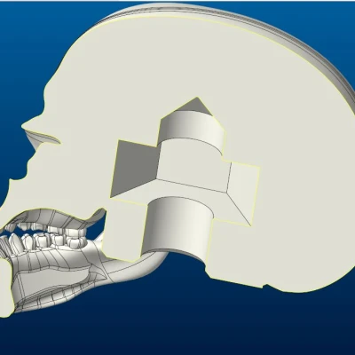 Nút Cần Số - Hộp Sọ