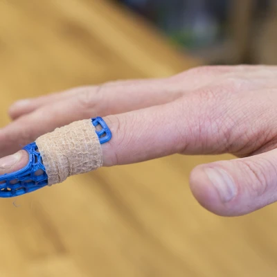 Băng đeo ngón tay (nẹp)