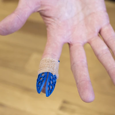 Băng đeo ngón tay (nẹp)