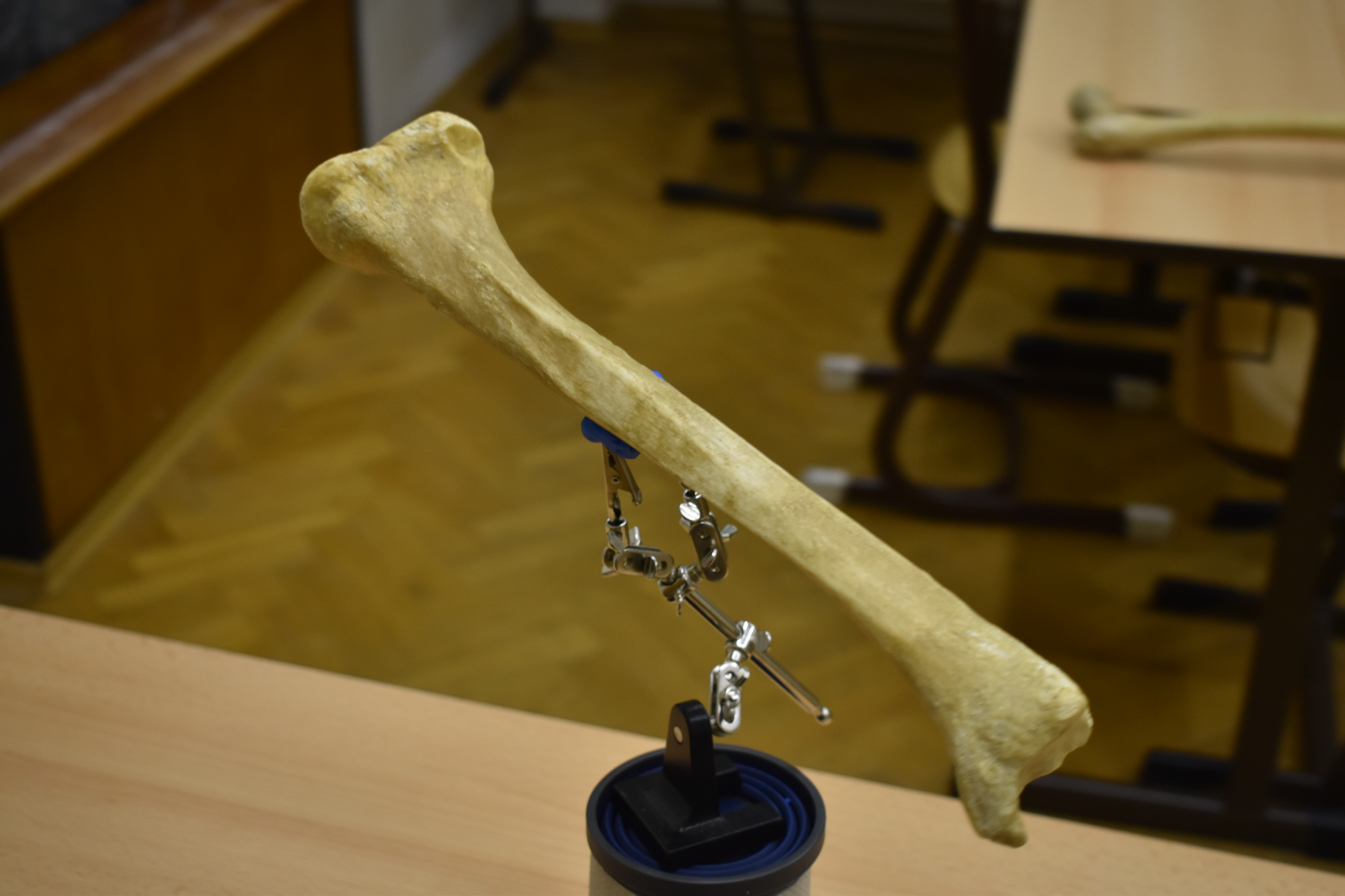 Xương chày - Shinbone Scan - Tibia