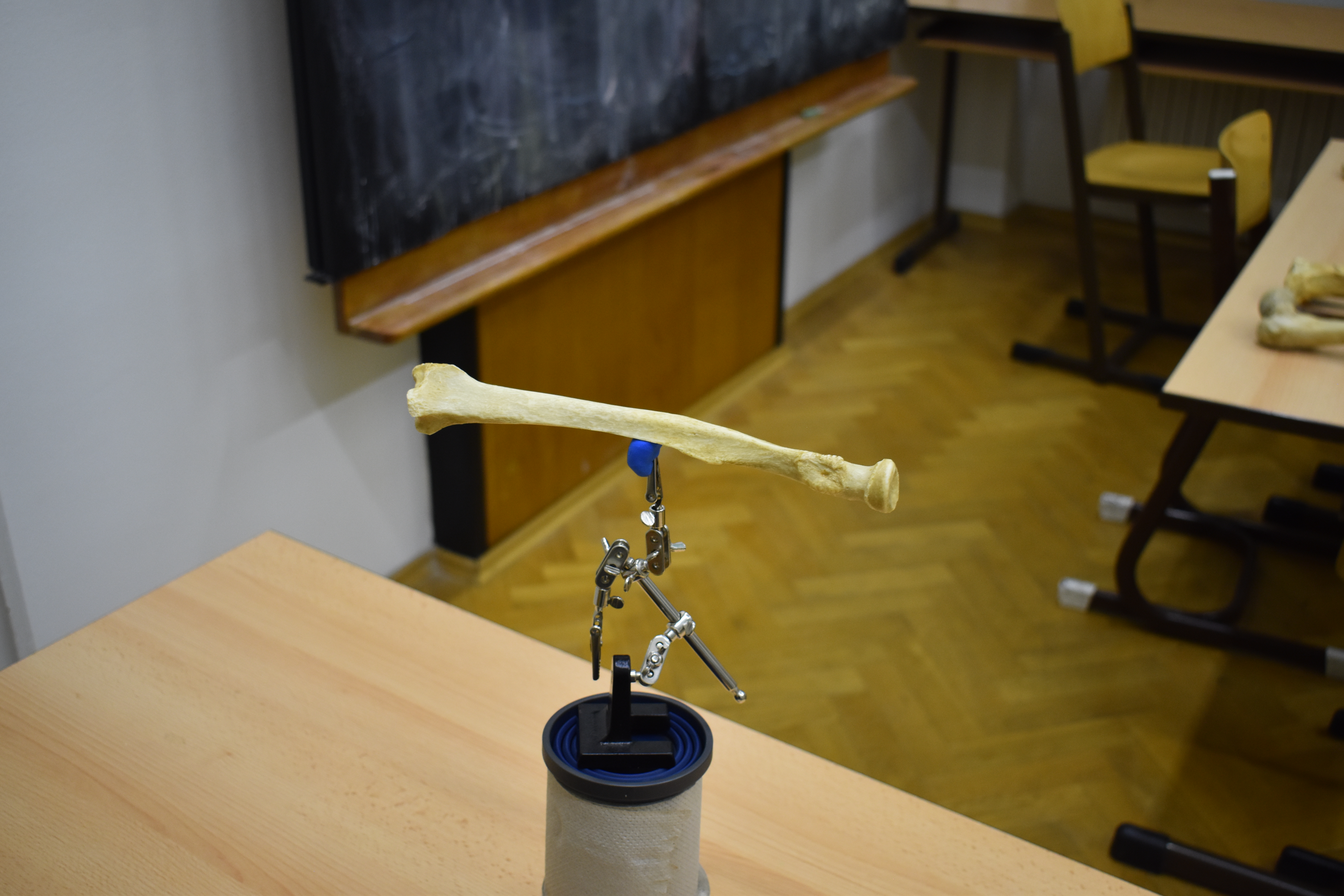 Quét 3D Xương Cẳng Tay - Xương Trụ