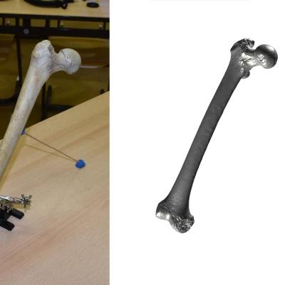 Xương Đùi (Femur) Quét 3D
