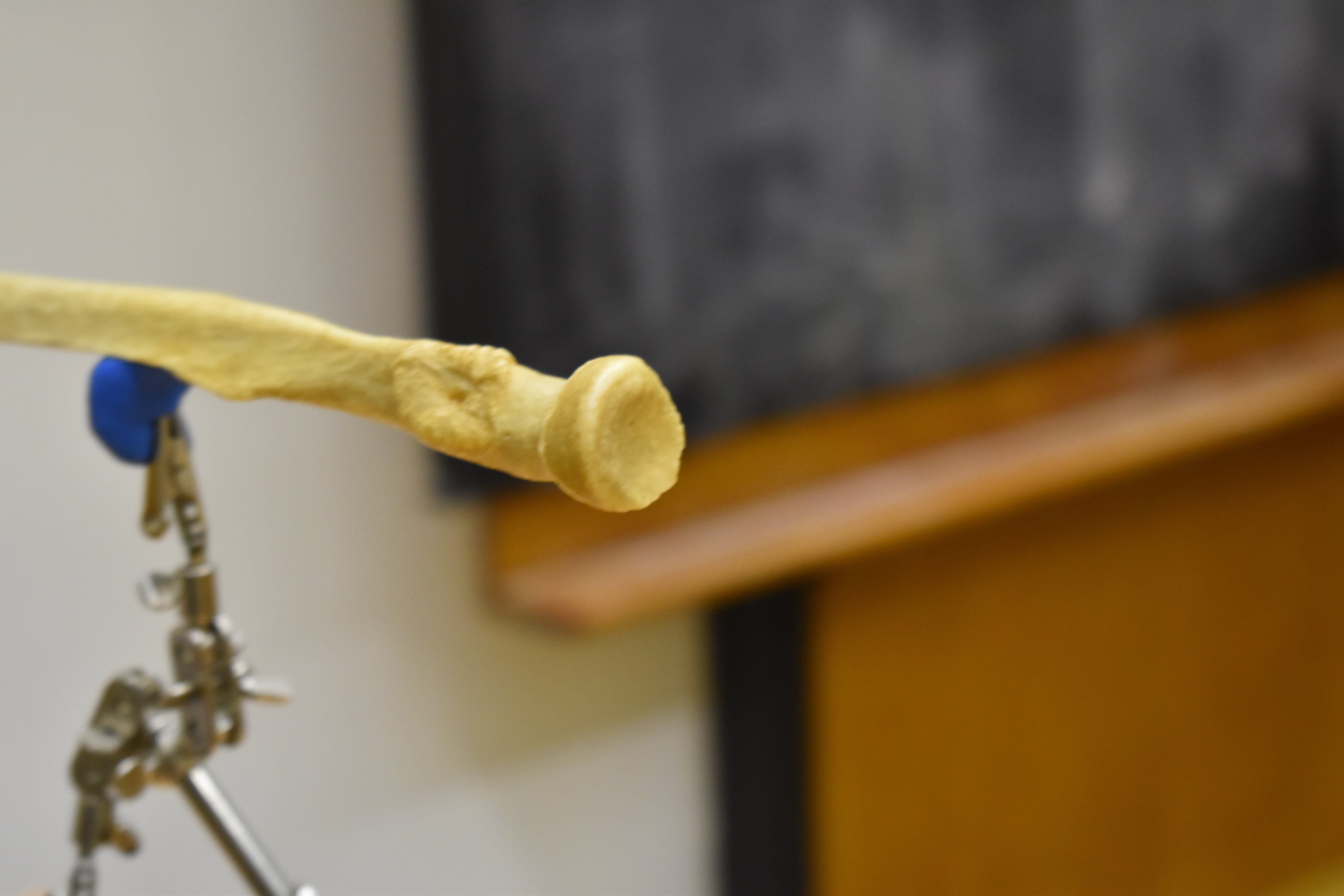 Quét 3D Xương Cẳng Tay - Xương Trụ