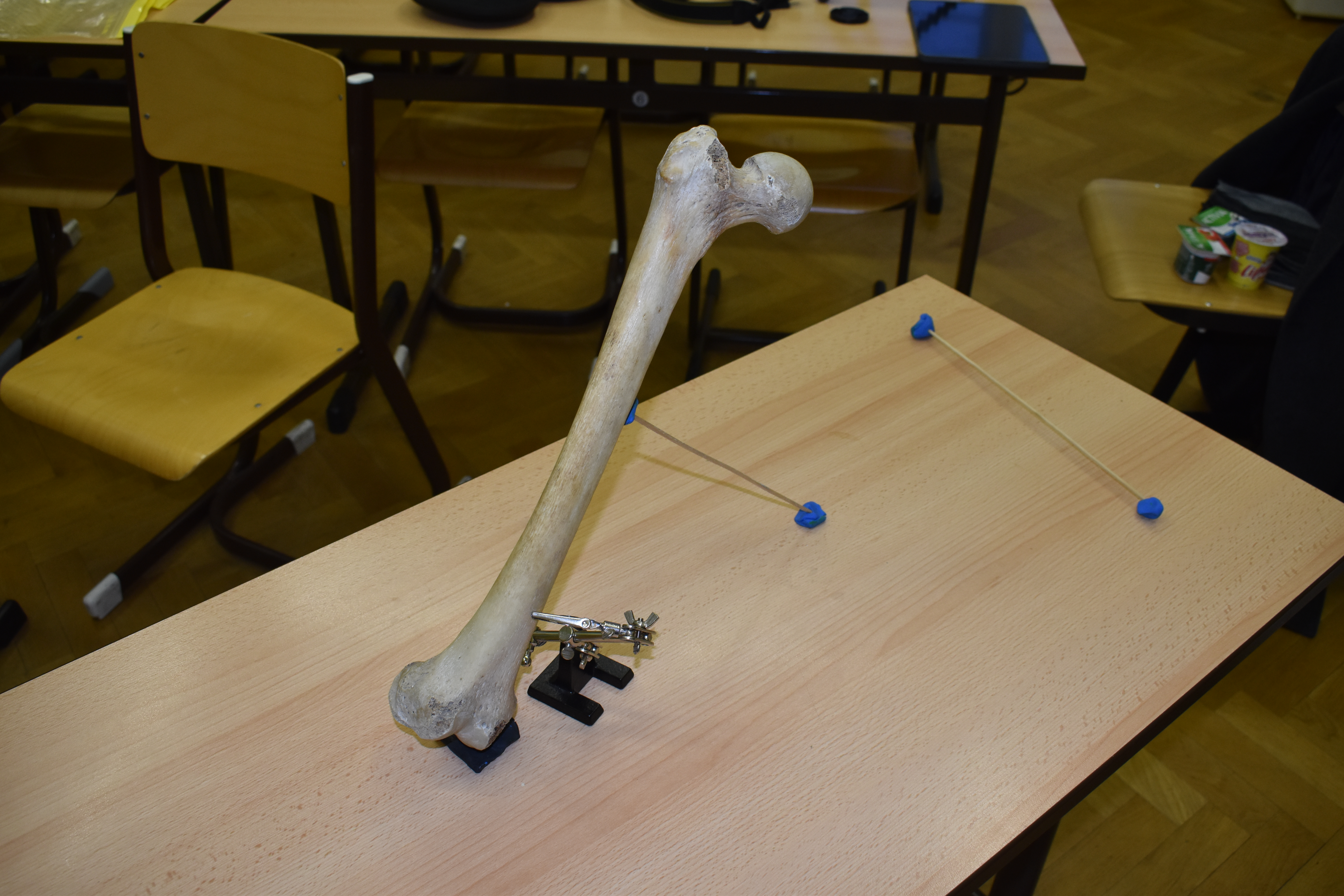 Xương Đùi (Femur) Quét 3D