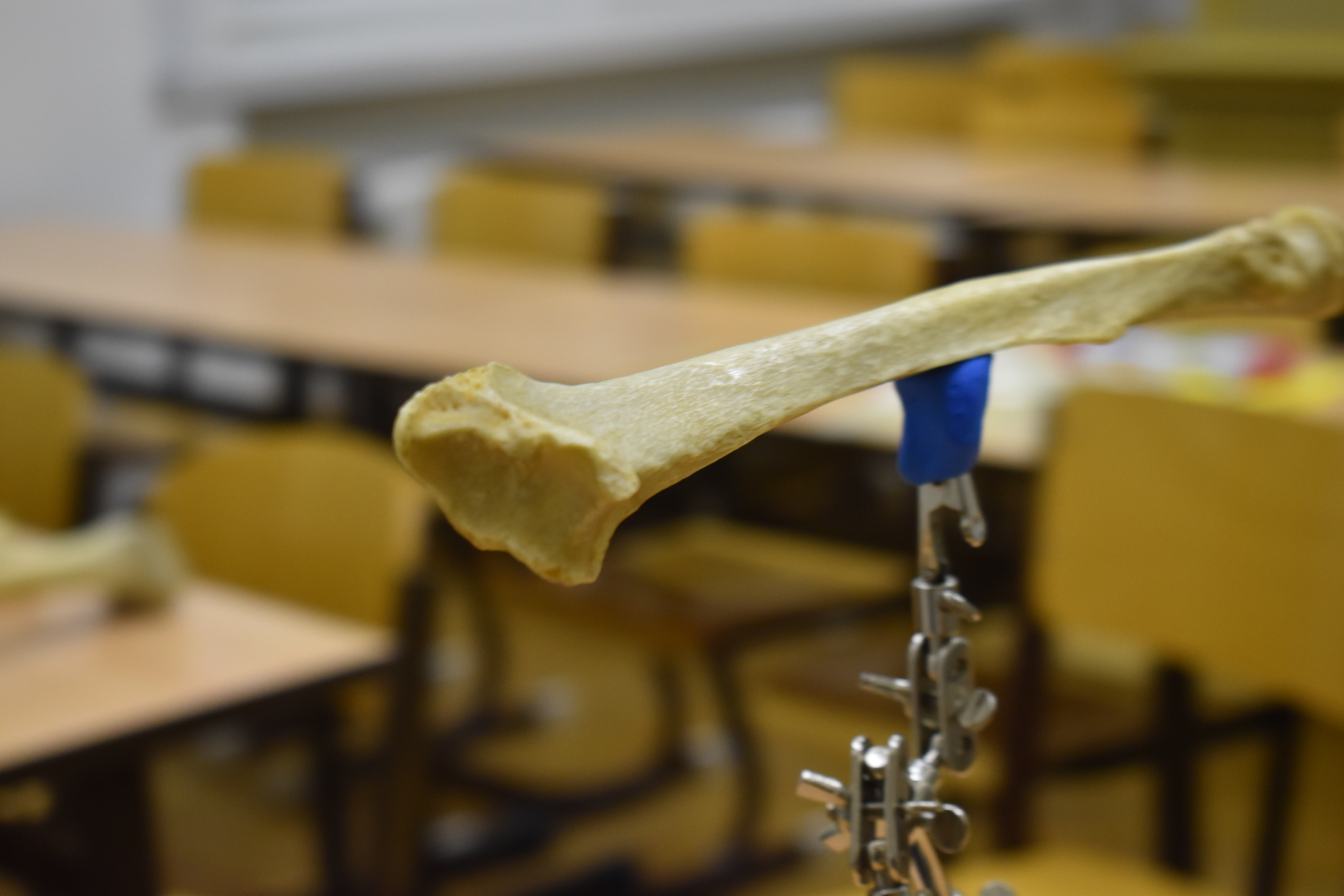 Quét 3D Xương Cẳng Tay - Xương Trụ