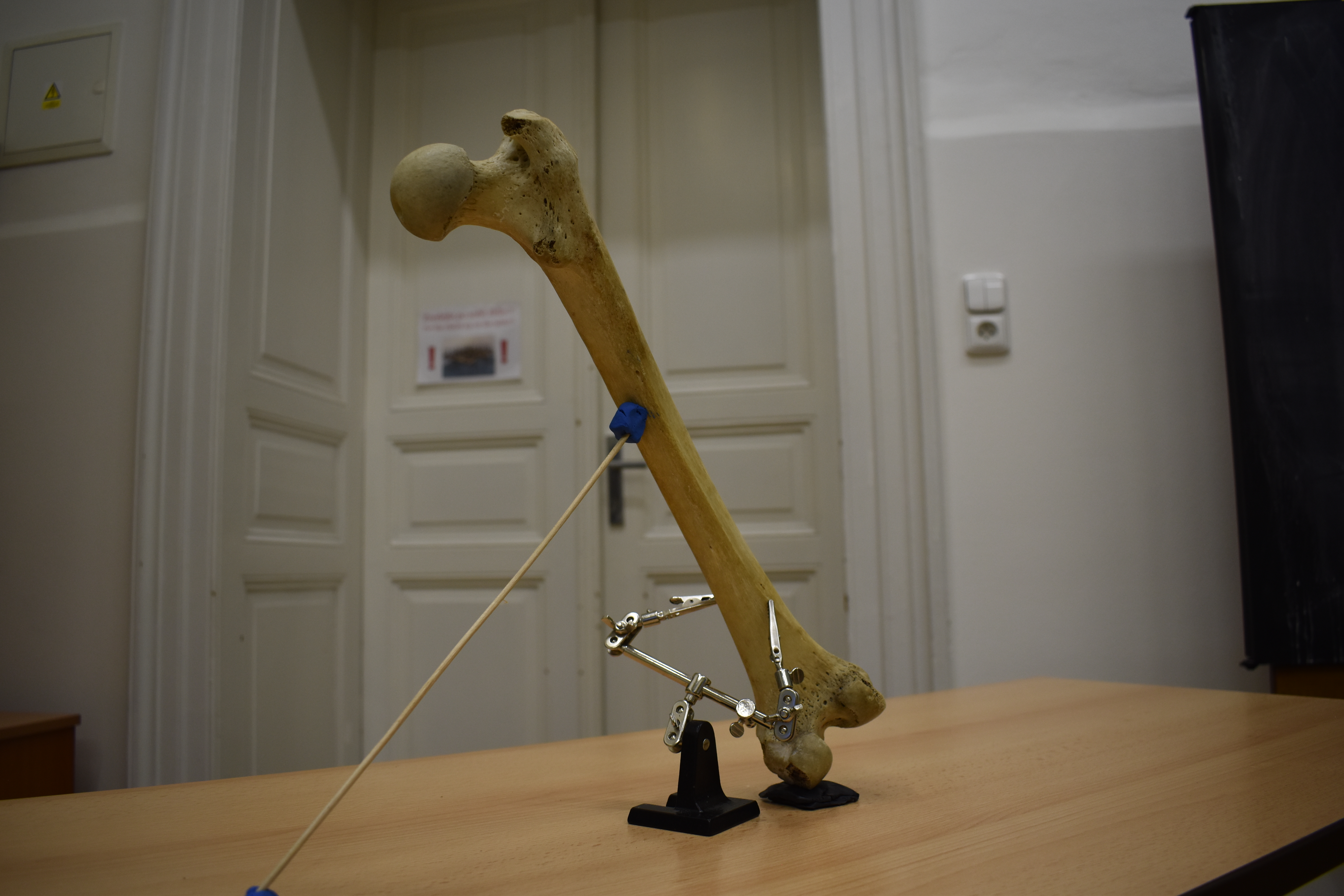 Xương Đùi (Femur) Quét 3D