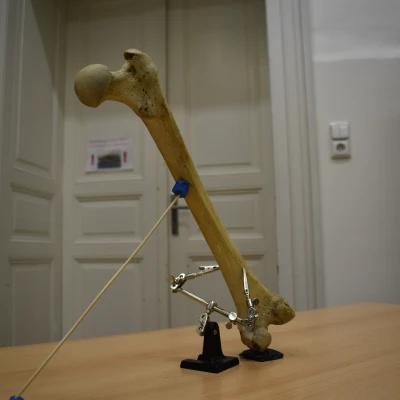 Xương Đùi (Femur) Quét 3D