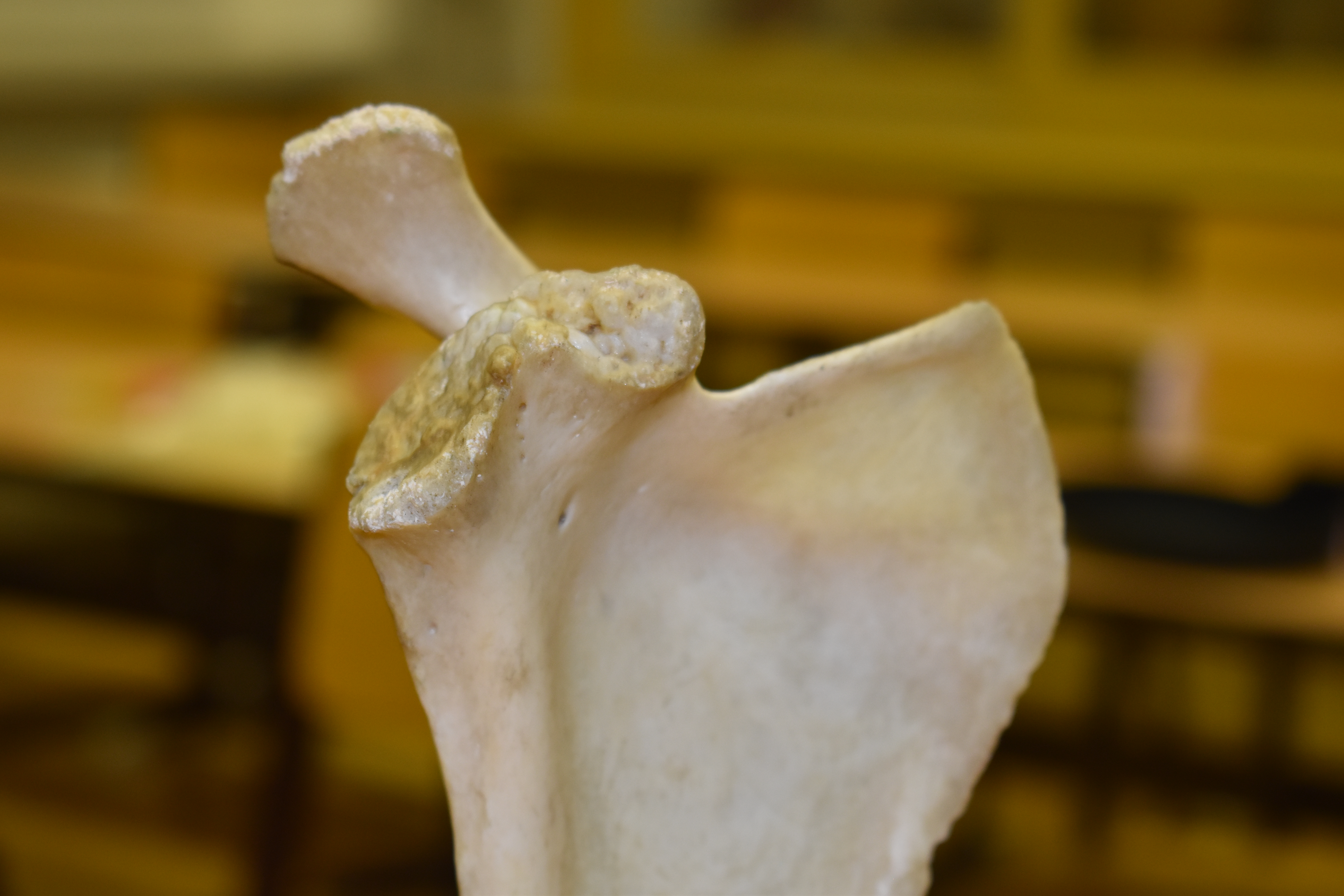 Xương Vai - Scapula (Bản Scan 3D)