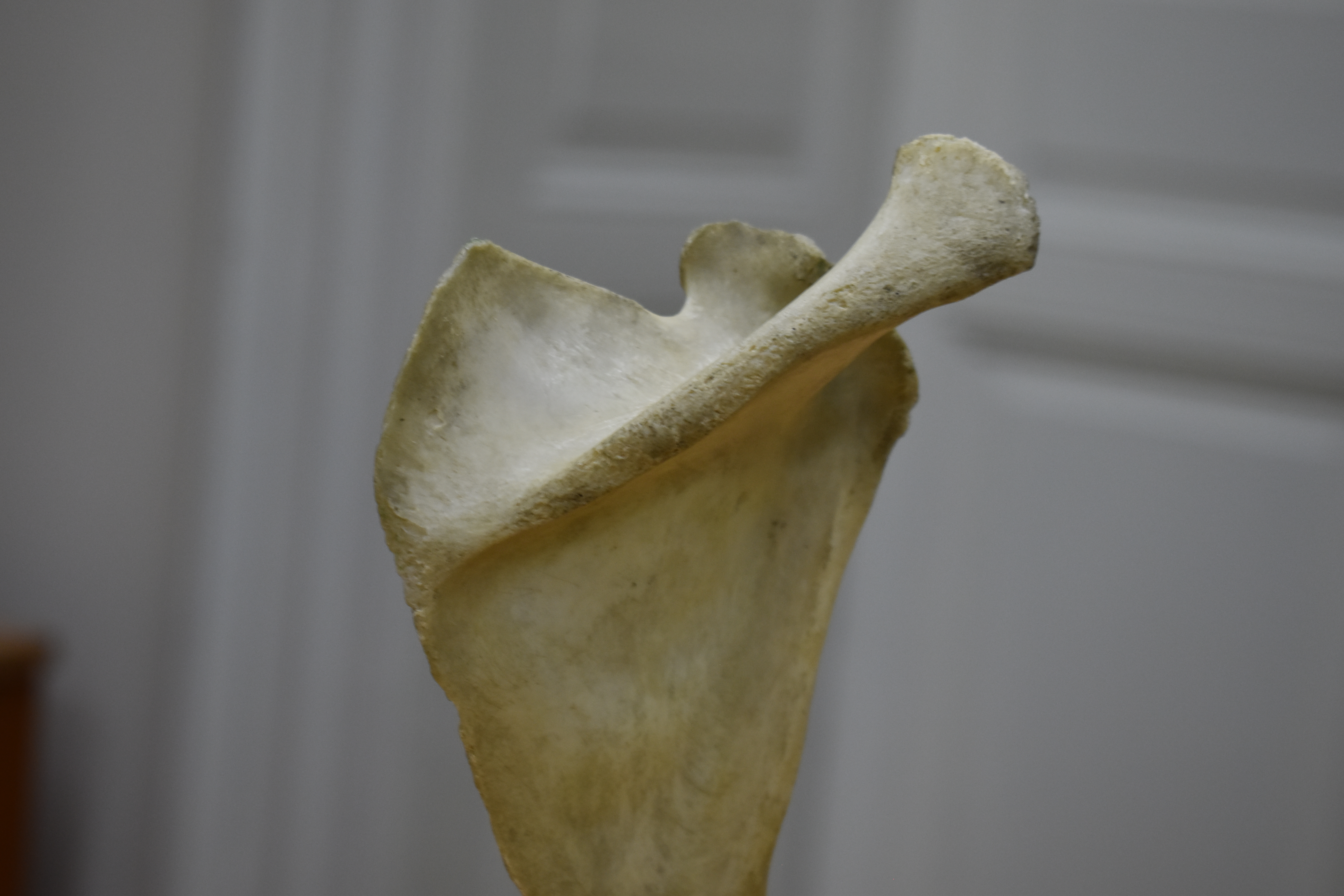 Xương Vai - Scapula (Bản Scan 3D)