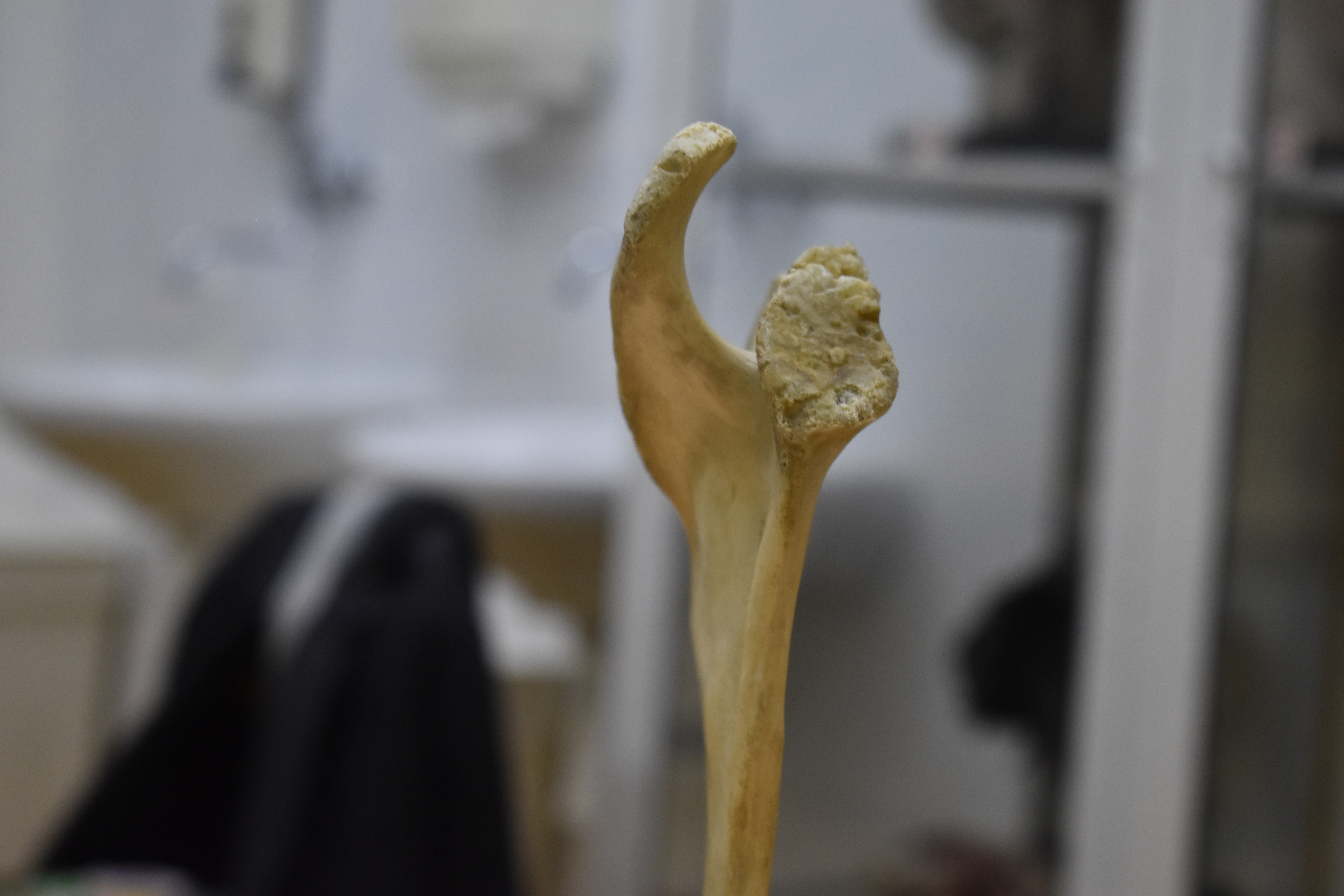 Xương Vai - Scapula (Bản Scan 3D)