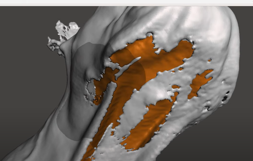 Phục Hồi Đường Viền Chồng Lấp Bằng MeshMixer (3D Scan)