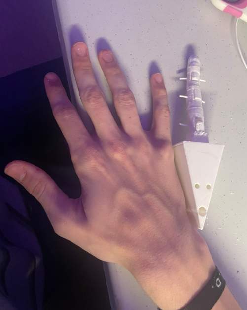 Ngón Tay Giả Thứ 6 V1