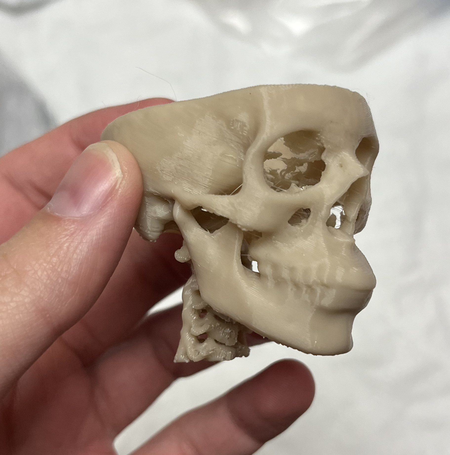 Sọ từ CT Scan 2.0 (có cột sống)