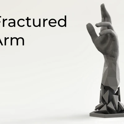 Cánh Tay Gãy