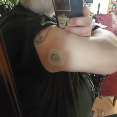 Hướng Dẫn Căn Chỉnh Miếng Dán Ngoài Dexcom G7