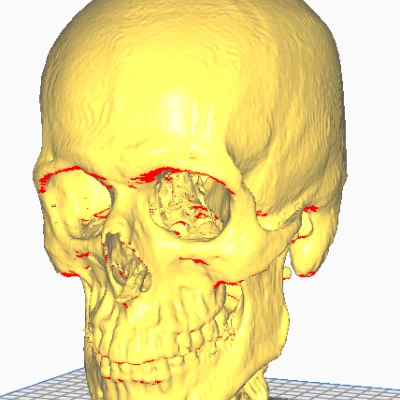 Mô hình CT Scan Hộp Sọ Người
