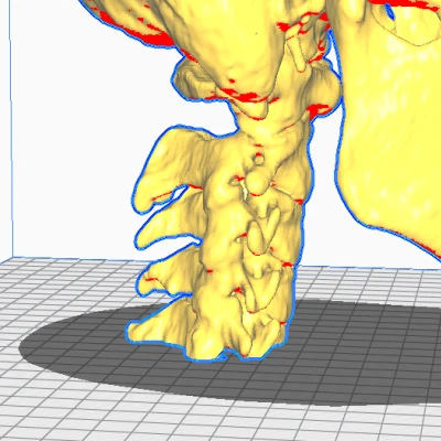 Mô hình CT Scan Hộp Sọ Người