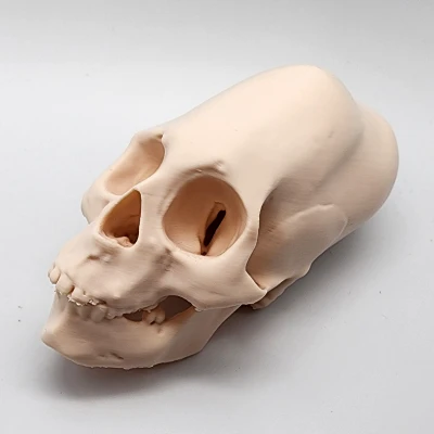 Hộp Sọ Người Peru Nữ Bị Bó Chặt